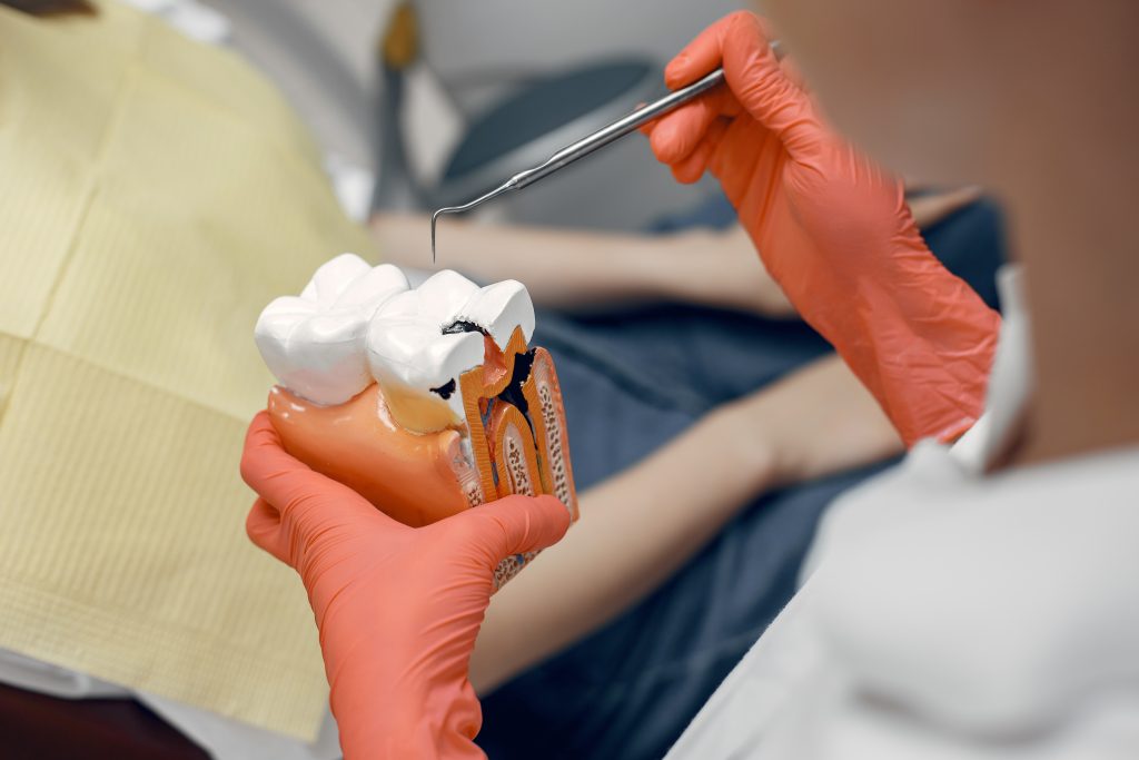 The Lowdown on Composite Fillings: Benefits, Care, and Lifespan